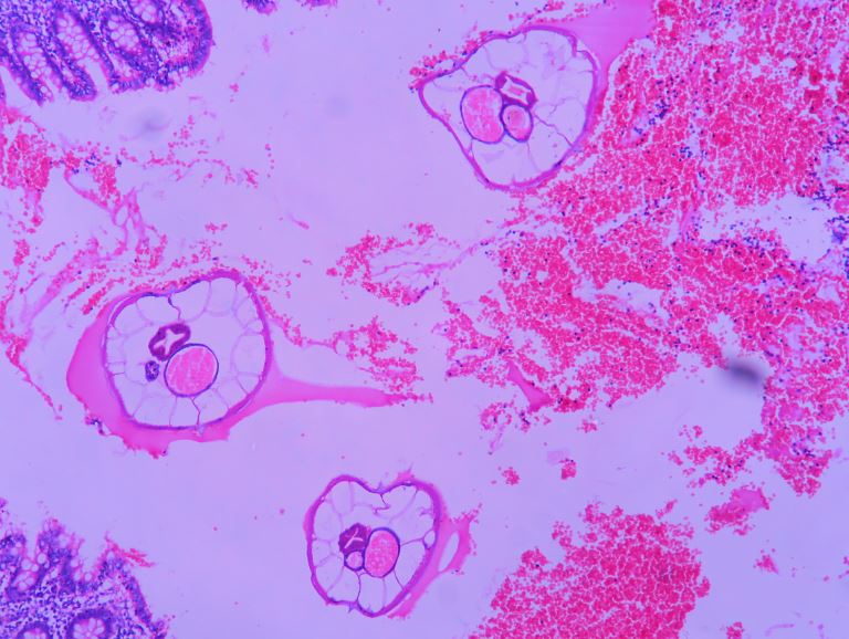 Enterobius vermicularis appendix histology, Enterobius vermicularis en perros