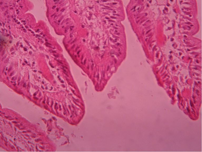 Giardia histology