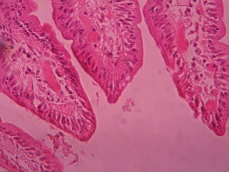 giardiasis duodenum histology