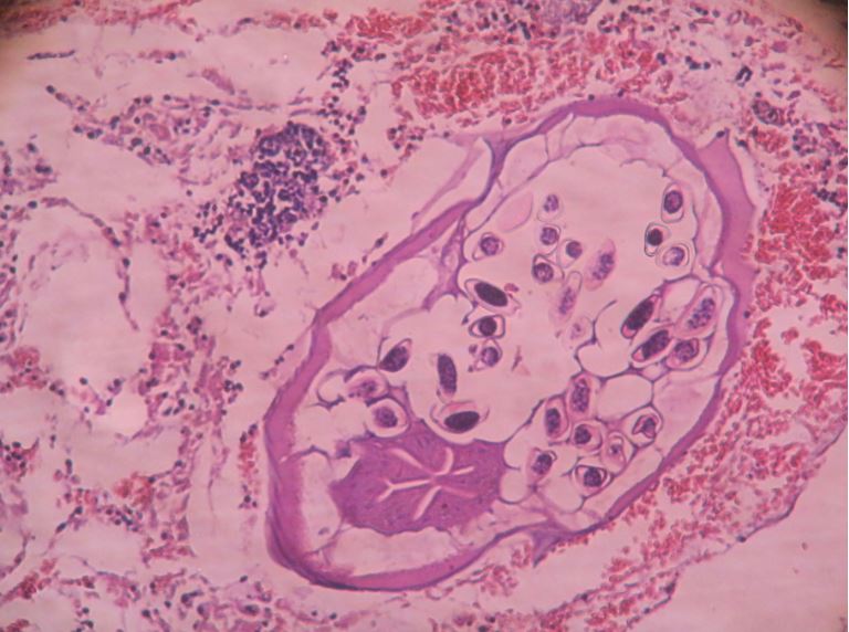 enterobius vermicularis histology