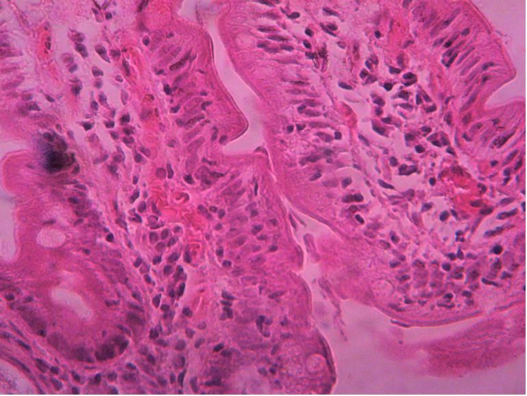 histologie giardia duodenum)